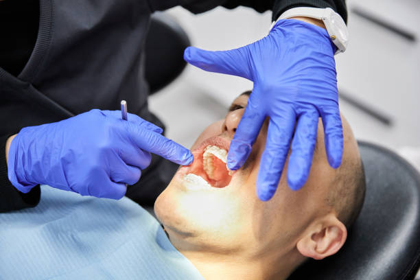 Best Emergency Dental Extractions in Seffner, FL